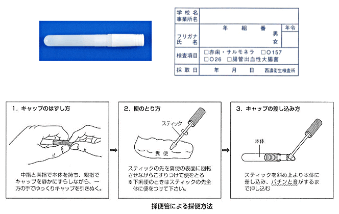 腸内細菌検査（検便）　便の取り方