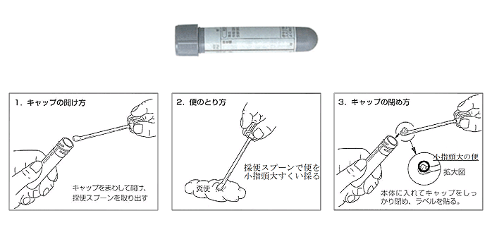 ノロウイルス検査　便の取り方